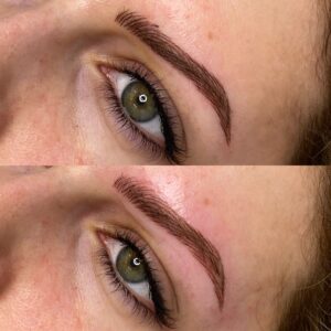 remove-unwanted-eyebrow