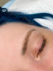 unwanted pigment in eyebrow