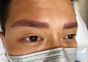 eyebrow-saline-removal